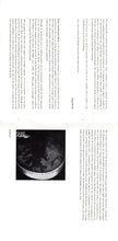 Load image into Gallery viewer, Various : Lament (CD, Album)